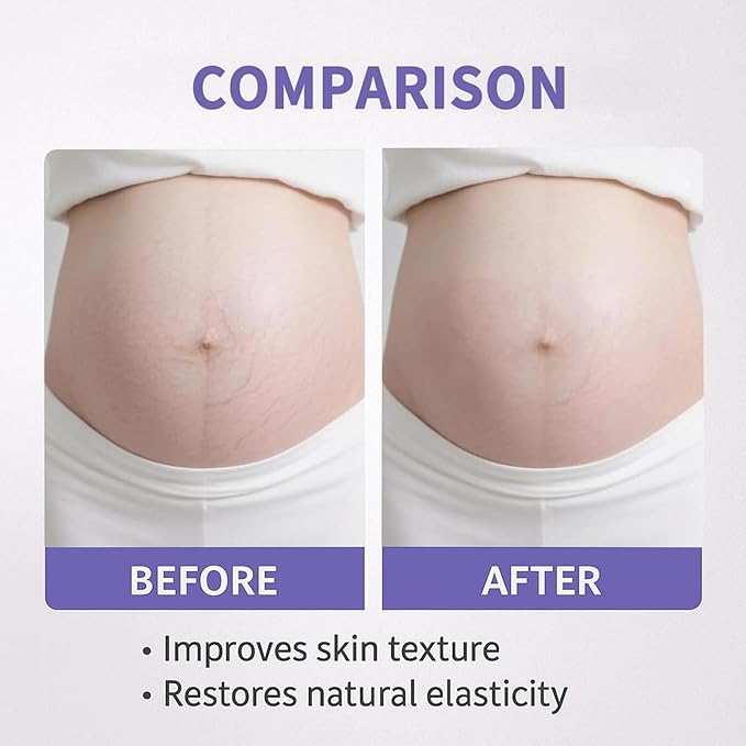 Nexiva Tighten & Smooth Belly Firming Cream
