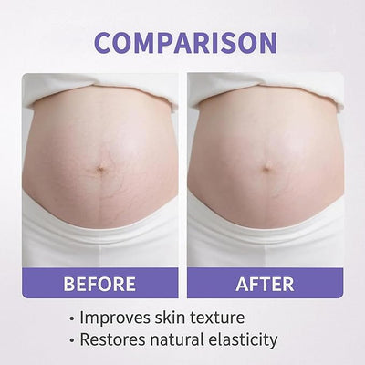 Nexiva Tighten & Smooth Belly Firming Cream